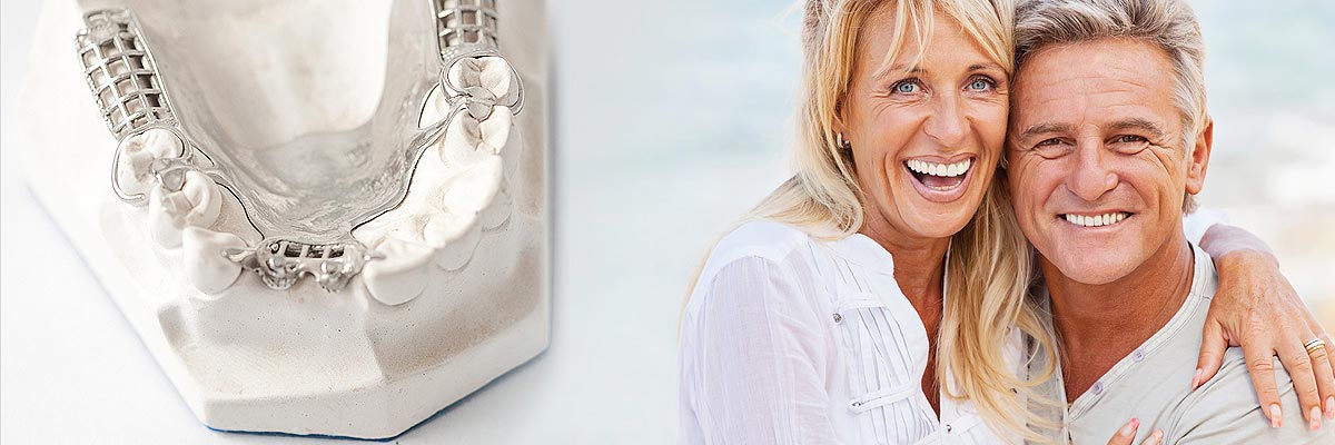 Santa Ana Implant Supported Dentures