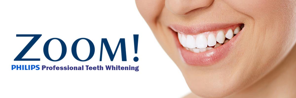 Santa Ana Zoom Teeth Whitening